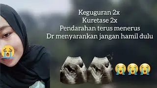 KEGUGURAN 2 KALI, ABIS KURET GAK BOLEH HAMIL LAGI 🥲