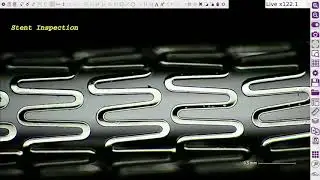 OMNI Core Application: Inspecting a Stent