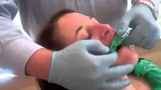 Dr Nick Fahey demonstrating conventional dental impressions