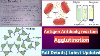 Antigen Antibody reactions | Ag-Ab reaction (Agglutination reaction)