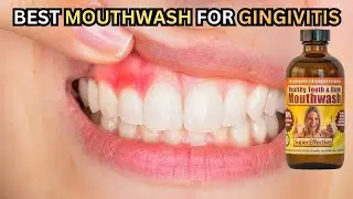 Ultimate Gingivitis Treatment! | Dr. Arenander's Organic Mouthwash Review 🌟🌱