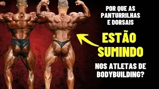 POR QUE AS PANTURRILHAS E DORSAIS SOMEM?`