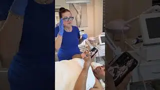 Live Demo of Skin Lightening and Laser Hair Removal on Dark Skin