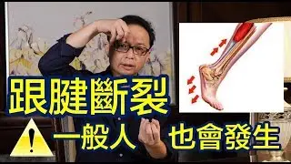 【跟腱斷裂】每個運動員最深沉的惡夢！