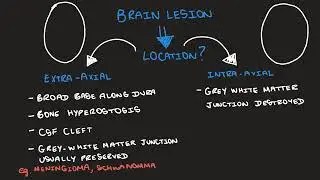 Intra-axial vs Extra-axial brain lesions