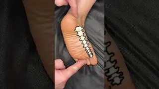 Китайская методика #массаж #здоровье #суджок #sujok #massage #лфк #самомассаж