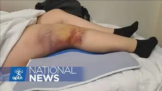 Alberta police watchdog to investigate Yukon RCMP arrest | APTN News