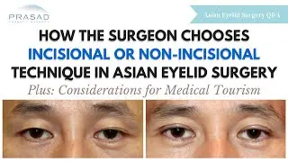 Extra Fat and Skin Determine Type of Asian Eyelid Surgery - Considerations for Medical Tourism