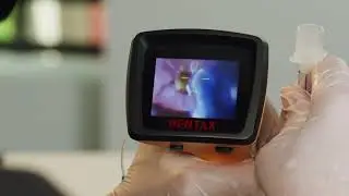 NK AWS-S200™ Video Laryngoscope