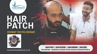 Looks Enhance Hair Patch | Looks Enhance Hair Weaving | Looks Enhance Hair Bonding -9889991666