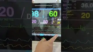 vet hospital patient monitor vet clinic monitor touch screen EtCo2 sensor