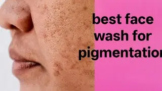 Best face wash for pigmentation#dailyvlog #dailylife#simplehousewife #familyfunvlog #lifeisbutadream