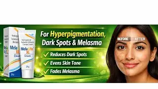 Melalite XL Cream | Dark Spots, Melasma Treatment | Uses, Apply Method, Side Effects | Hindi