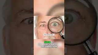 Eye Health: Warning Signs You Shouldn't Ignore!