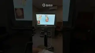 Scanner 3D - Olhar Conceito