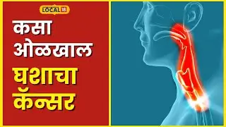 Health News घशात येतोय सारखा कफ? दुर्लक्ष करू नका, लगेच घ्या डॉक्टरांचा सल्ला #local18