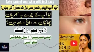 whitening cream banane ka tarika || skin a cream review || glowing cream for face