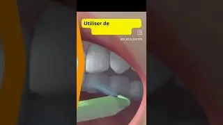 Brosse interdentaire.  Utilisation facile #dentifrice