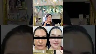 8830000565 #thedimpleahuja #skincare #lifeisbutadream #fashion
