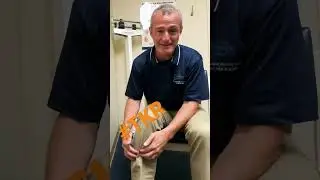 Meniscus Knee Arthritis