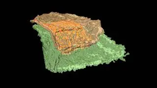 JID July 2023 Cover: Secretion of Epidermal Lamellar Granules Revealed by 3D Electron Microscopy