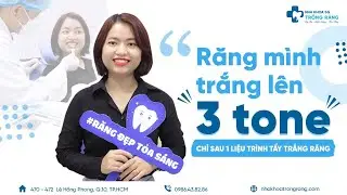 Răng ố v&agrave;ng l&agrave;m sao để trắng? | Review tẩy trắng răng c&ocirc;ng nghệ Mỹ