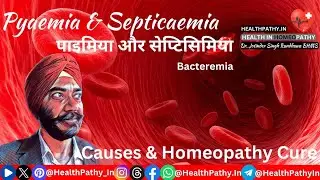 Pyaemia & Septicaemia: Causes & Homeopathy Cure पाइमिया और सेप्टिसिमिया | प्येमिया