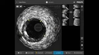 IntraSight Intuitive Interface