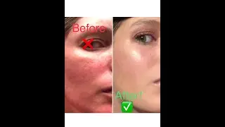 10 Tricks & Tips to Minimize Pores