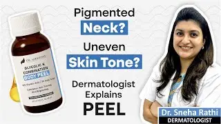 Doctor Explains Glycolic K Body Peel | Fix Dark Elbows, Rough Neck, and Uneven Skin FAST