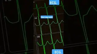 How ECG Machines Work