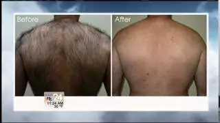 Better Living: Luxe Laser Center
