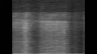 South American TVDX