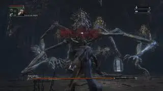 Amygdala vs 99 arcane build