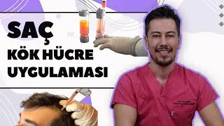 Saç Kök Hücre Uygulaması | Dr. Bora Özel