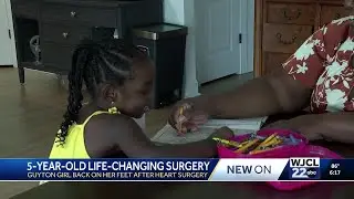 Guyton 5-year-old bounces back after life-saving heart surgery