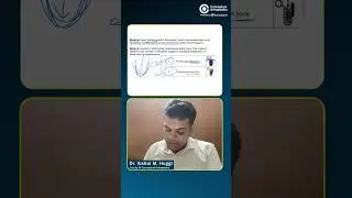 Mode of Failure of cemented stems by Dr. Vishal Huggi