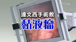 黏液瘤 你聽過嗎？