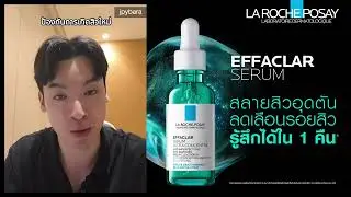 Acne reducing serum