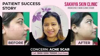 Real Patient Success Story &ndash; Skin Glow & Pigmentation Treatment
