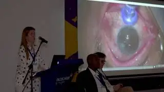 Tratamiento de glaucoma con terapia MicroPulse de IRIDEX - Dra. Maria Fernanda Delgado