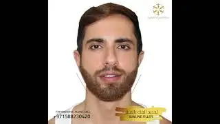 Dermal Fillers Injections in Dubai & Abu Dhabi | Dermal Fillers Cost