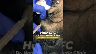 Hair GFC Treatment for Hair Fall | Strengthen Roots & Improve Hair Density
