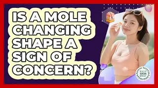 Is a Mole Changing Shape a Sign of Concern?