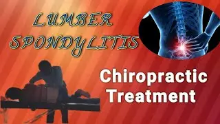 Lumber Spondylitis | Backache | कमरदर्द पीठदर्द | Treatment @DrUmeshKale Chiropractor #painrelief 