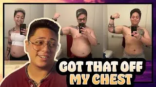 1 Year After Top Surgery (2 Months After Revision) | Trans FTM