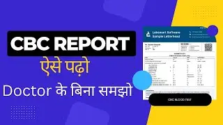 CBC Test Full Details | Hemoglobin, WBC, RBC Sab Samjhe Ek Video Me | Hindi Me
