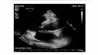 Cardiac Case Studies Series: Valvular Disease-Sample Excerpt