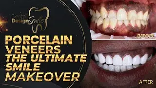 The ultimate smile makeover