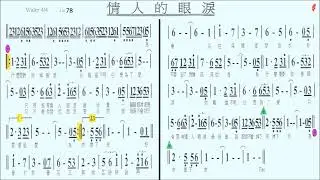 103情人的眼淚Bb(導音),蔡琴,伴奏,簡譜卡拉OK(kalaoke)歡迎訂閱+小鈴鐺,按讚...隨時收新消息